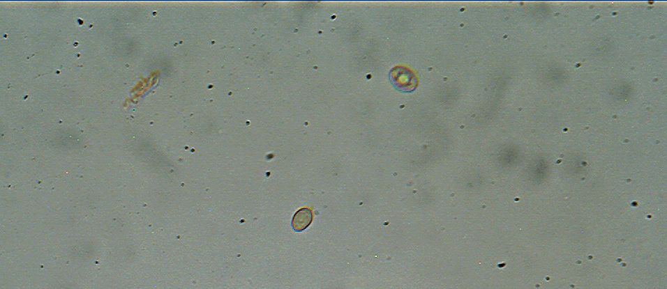 Phaeomarasmius erinaceus